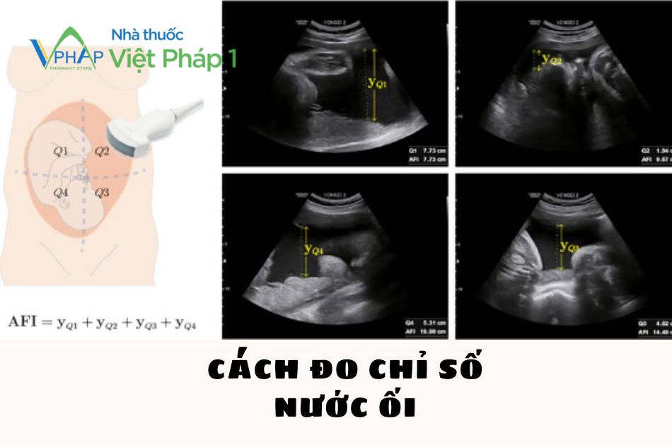 Cách đo chỉ số nước ối