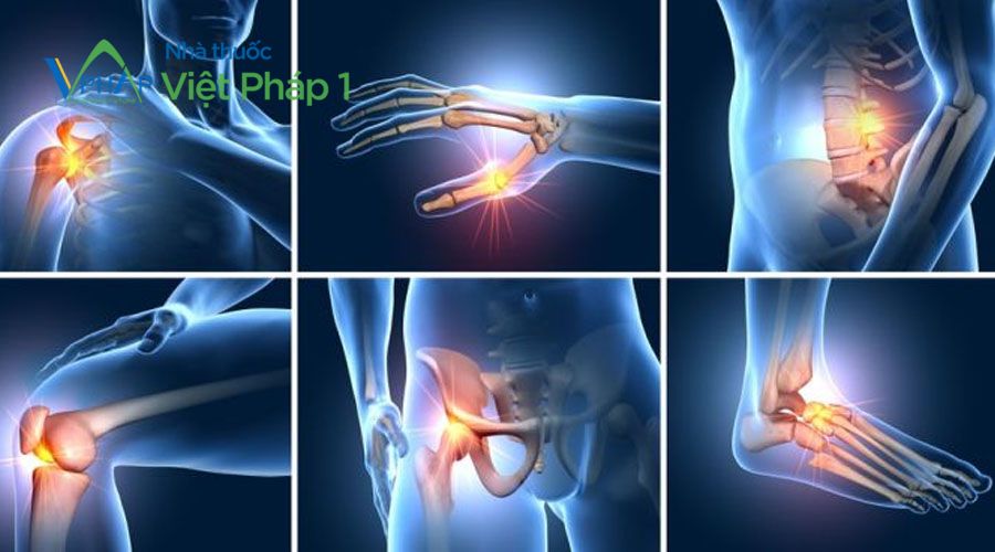 Thuốc giảm đau xương khớp